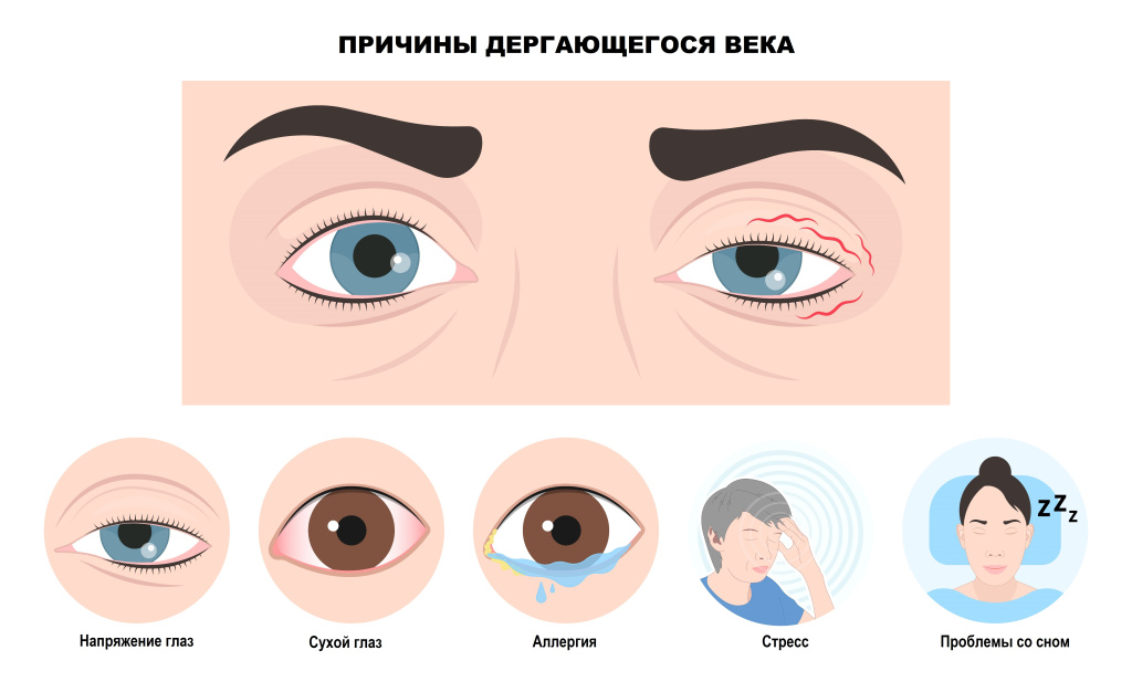 Крупный план глаза с анимацией подергивания века или схематичное изображение